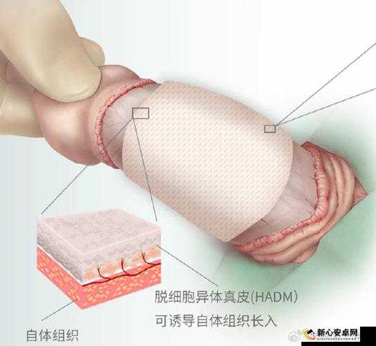 阳具尺寸合适究竟该如何选择：科学探讨与合适标准